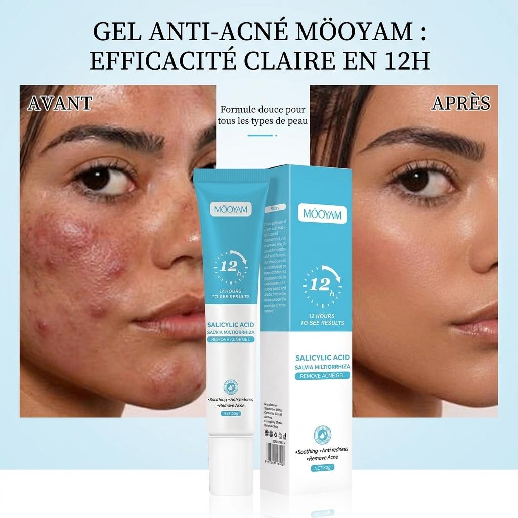 MOOYAM Anti-acné