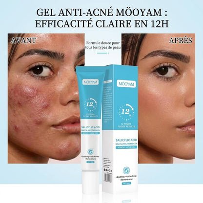 MOOYAM Anti-acné