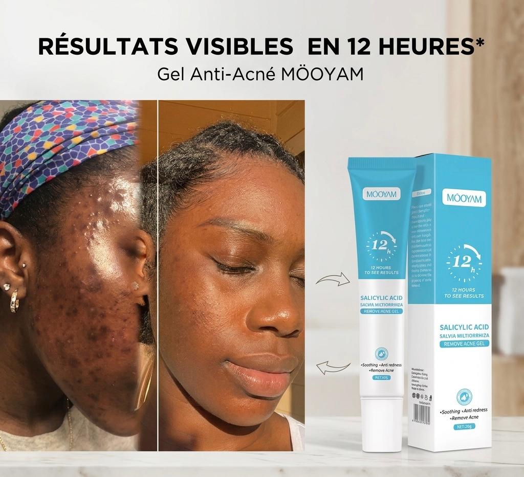 MOOYAM Anti-acné